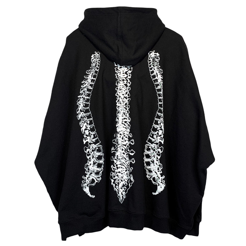 surgery spine over hoodie