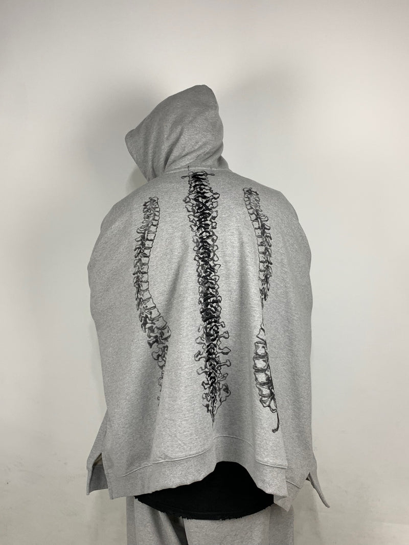 surgery spine over hoodie